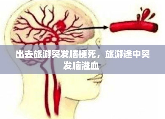 出去旅游突发脑梗死，旅游途中突发脑溢血 
