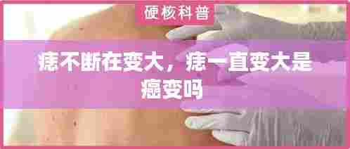痣不断在变大,痣一直变大是癌变吗