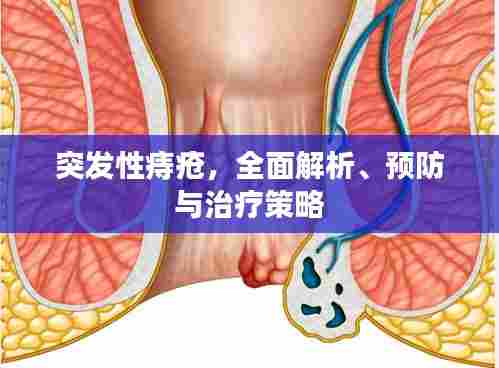 突发性痔疮,全面解析、预防与治疗策略