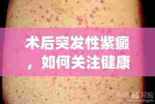 术后突发性紫癜,如何关注健康,预防意外风险?