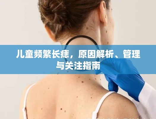 儿童频繁长痣，原因解析、管理与关注指南